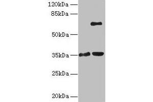 Western blot All lanes: ZNF75A antibody at 10 μg/mL Lane 1: Mouse brain tissue Lane 2: Mouse liver tissue Secondary Goat polyclonal to rabbit IgG at 1/10000 dilution Predicted band size: 35 kDa Observed band size: 35, 65 kDa (ZNF75A 抗体  (AA 1-296))