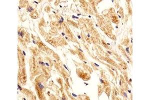 IHC analysis of FFPE human heart section using Integrin beta 8 antibody; Ab was diluted at 1:25. (ITGB8 抗体  (AA 197-231))