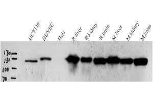 Western Blot analysis of various samples using N-cadherin Polyclonal Antibody at dilution of 1:1000. (N-Cadherin 抗体)