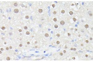 Immunohistochemistry of paraffin-embedded Rat liver using MLF2 Polyclonal Antibody at dilution of 1:100 (40x lens). (MLF2 抗体)