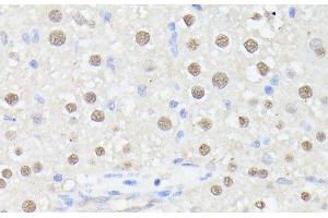 Immunohistochemistry of paraffin-embedded Rat liver using MLF2 Polyclonal Antibody at dilution of 1:100 (40x lens). (MLF2 抗体)