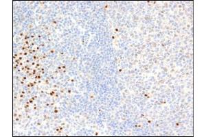 Immunohistochemistry using PIM2 mAb. (PIM2 抗体)