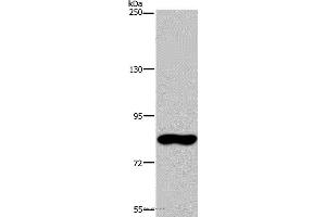 Western blot analysis of Hela cell, using FAF1 Polyclonal Antibody at dilution of 1:400 (FAF1 抗体)