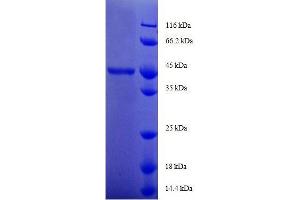 SDS-PAGE (SDS) image for GM2 Ganglioside Activator (GM2A) (AA 32-193), (full length) protein (GST tag) (ABIN7479205)