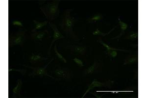 Immunofluorescence of monoclonal antibody to GCHFR on HeLa cell. (GCHFR 抗体  (AA 1-84))