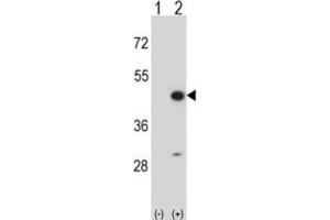 Western Blotting (WB) image for anti-Creatine Kinase, Mitochondrial 2 (Sarcomeric) (CKMT2) antibody (ABIN3002971) (CKMT2 抗体)