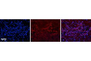 Rabbit Anti-GPD1 Antibody   Formalin Fixed Paraffin Embedded Tissue: Human Liver Tissue Observed Staining: Cytoplasm in bile ductule Primary Antibody Concentration: 1:100 Other Working Concentrations: N/A Secondary Antibody: Donkey anti-Rabbit-Cy3 Secondary Antibody Concentration: 1:200 Magnification: 20X Exposure Time: 0. (GPD1 抗体  (N-Term))