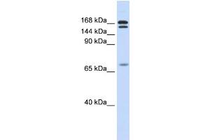WB Suggested Anti-CUX2 Antibody Titration:  0.