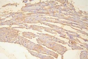 IHC analysis of Hsp20 using anti-Hsp20 antibody (ABIN5518920).