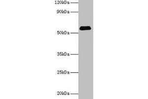 Western blot All lanes: SUOX antibody at 2 μg/mL + Rat liver tissue Secondary Goat polyclonal to rabbit IgG at 1/15000 dilution Predicted band size: 61 kDa Observed band size: 61 kDa (SUOX 抗体  (AA 80-545))