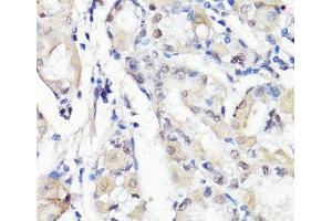 Immunohistochemistry of paraffin-embedded Human stomach using TBX20 Polyclonal Antibody at dilution of 1:100 (40x lens). (TBX20 抗体)
