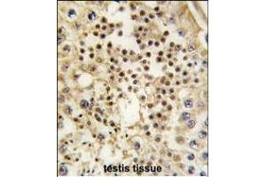 Formalin-fixed and paraffin-embedded human testis tissue reacted with LIN28A Monoclonal Antibody (ABIN387790 and ABIN2838026) , which was peroxidase-conjugated to the secondary antibody, followed by DAB staining. (LIN28A 抗体)