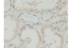 Immunohistochemistry (IHC) image for anti-Abl-Interactor 1 (ABI1) (AA 1-182) antibody (ABIN7436735)