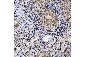 IHC analysis of SNRNP200 using anti-SNRNP200 antibody (ABIN7602032). (SNRNP200 抗体  (AA 557-2129))