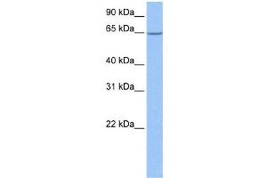 Western Blot showing NOL5A antibody used at a concentration of 1-2 ug/ml to detect its target protein. (NOP56 抗体)