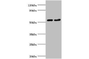 Western blot All lanes: Septin-7 antibody at 9 μg/mL Lane 1: Hela whole cell lysate Lane 2: Mouse gonad tissue Secondary Goat polyclonal to rabbit IgG at 1/10000 dilution Predicted band size: 51 kDa Observed band size: 51 kDa (Septin 7 抗体  (AA 308-437))