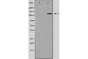 Western blot analysis of Hela whole cell lysates, using UPF1  Antibody. (RENT1/UPF1 抗体)