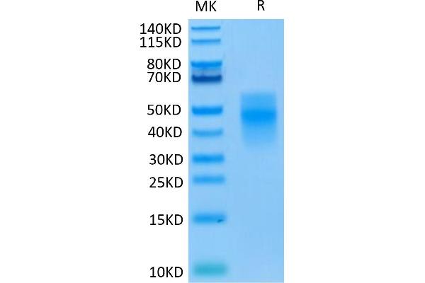 TREM1 Protein (His tag)