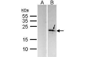 WB Image Western Blot analysis of MKP-6 expression in transfected 293T cell line (20ug of whole cell ltsate) A: Non-transfected lysate. (DUSP14 抗体  (C-Term))