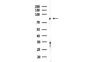 anti-Cell Division Cycle 16 Homolog (S. Cerevisiae) (CDC16) (Internal Region) antibody
