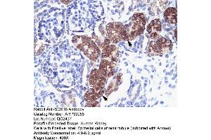 Rabbit Anti-SOX18 Antibody  Paraffin Embedded Tissue: Human Kidney Cellular Data: Epithelial cells of renal tubule Antibody Concentration: 4. (SOX18 抗体  (Middle Region))