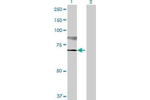 Western Blot analysis of ST6GALNAC1 expression in transfected 293T cell line by ST6GALNAC1 MaxPab polyclonal antibody. (ST6GALNAC1 抗体  (AA 1-600))