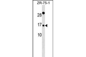 TI Antibody (Center) (ABIN6242753 and ABIN6577350) western blot analysis in ZR-75-1 cell line lysates (35 μg/lane). (TIMM9 抗体  (AA 18-44))