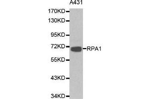 Western blot analysis of A431 cell lysate using RPA1 antibody. (RPA1 抗体  (AA 367-616))