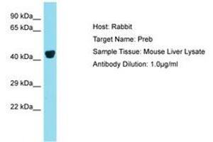 Image no. 1 for anti-Prolactin Regulatory Element Binding (PREB) (N-Term) antibody (ABIN6750398)