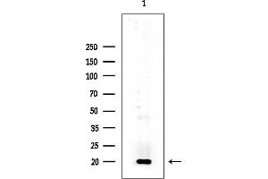 Western blot analysis of lysates from Mouse liver, using SOD1 Mouse Monoclonal Antibody at 1/1000 dilution.
