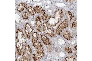 Immunohistochemical staining of human kidney with ESPN polyclonal antibody  shows strong membranous and weak nuclear positivity in tubular cells. (Espin 抗体)