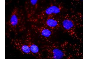 Proximity Ligation Analysis of protein-protein interactions between SNCA and APP.