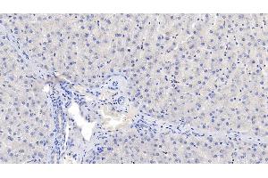Detection of NOS2 in Human Liver Tissue using Monoclonal Antibody to Nitric Oxide Synthase 2, Inducible (NOS2) (NOS2 抗体  (AA 533-696))