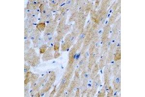 Immunohistochemical analysis of OGT staining in rat heart formalin fixed paraffin embedded tissue section. (OGT 抗体)