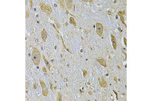 Immunohistochemistry of paraffin-embedded mouse brain using ITGA2 Antibody (ABIN2563445) at dilution of 1:100 (40x lens).