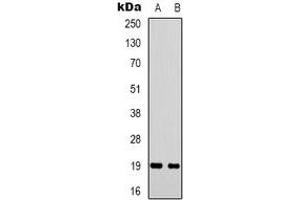 Western blot analysis of STMN1 expression in Hela (A), COS7 (B) whole cell lysates. (Stathmin 1 抗体  (N-Term))