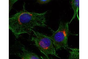 Immunocytochemistry (ICC) image for anti-RAB6A, Member RAS Oncogene Family (RAB6A) (AA 1-205) antibody (ABIN1742534) (RAB6A 抗体  (AA 1-205))