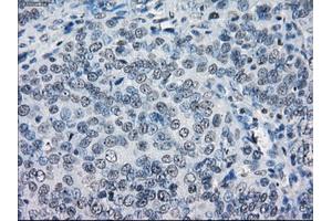 Immunohistochemical staining of paraffin-embedded colon tissue using anti-LTA4Hmouse monoclonal antibody. (LTA4H 抗体)