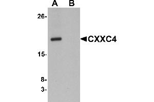 Western Blotting (WB) image for anti-CXXC Finger Protein 4 (CXXC4) (N-Term) antibody (ABIN1031338)