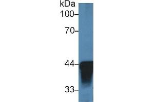 Detection of ADH1 in Human Liver lysate using Polyclonal Antibody to Alcohol Dehydrogenase 1 (ADH1) (ADH1 抗体  (AA 25-228))