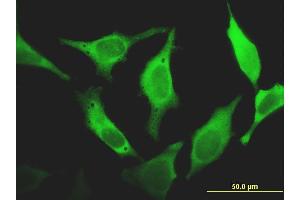 Immunofluorescence of monoclonal antibody to FHIT on HeLa cell. (FHIT 抗体  (AA 31-130))