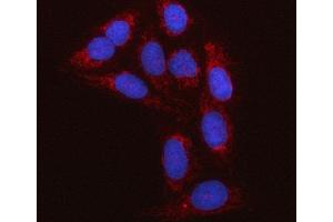 IF analysis of C18orf22/RBFA using anti-C18orf22/RBFA antibody (ABIN7600106).