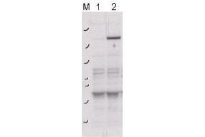 Western blot using  affinity purified anti-ROCK-2 pY256 antibody shows detection of phosphorylated ROCK-2 in transfected 293T cells. (ROCK2 抗体  (pTyr256))