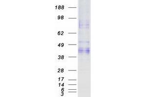 Western Blotting (WB) image for Asialoglycoprotein Receptor 2 (ASGR2) (Transcript Variant 3) protein (Myc-DYKDDDDK Tag) (ABIN2714983)