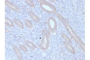 Formalin-fixed, paraffin-embedded human Endometrium stained with ATG5 Mouse Monoclonal Antibody (ATG5/2553). (ATG5 抗体  (AA 1-119))