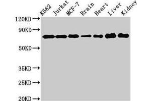 Western Blot Positive WB detected in: K562 whole cell lysate, Jurkat whole cell lysate, MCF-7 whole cell lysate, Rat brain tissue, Rat heart tissue, Mouse liver tissue, Mouse kidney tissue All lanes: DDX3X antibody at 3 μg/mL Secondary Goat polyclonal to rabbit IgG at 1/50000 dilution Predicted band size: 74, 72 kDa Observed band size: 74 kDa (DDX3X 抗体  (AA 2-662))