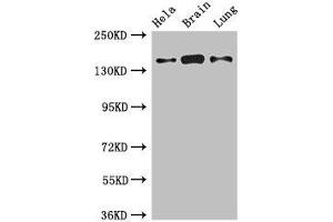 Western Blot Positive WB detected in: Hela whole cell lysate, Mouse brain tissue, Rat lung tissue All lanes: SULF2 antibody at 2. (SULF2 抗体  (AA 463-660))