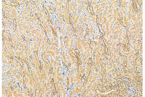 ABIN6261290 and ABIN6272914 at 1/100 staining Rat kidney tissue by IHC-P.