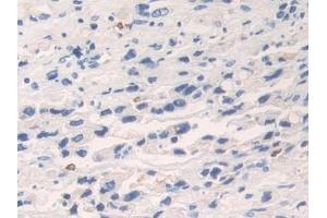 Immunohistochemistry (IHC) image for anti-Kallikrein 6 (KLK6) (AA 17-244) antibody (ABIN7432397)