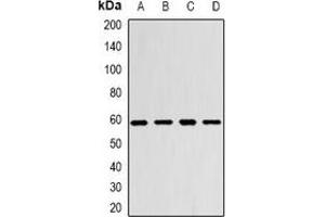 Western blot analysis of Monoamine Oxidase B expression in SW480 (A), Hela (B), mouse brain (C), mouse heart (D) whole cell lysates. (Monoamine Oxidase B 抗体)
